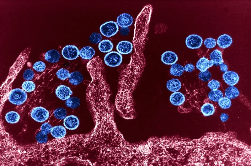 Hantavirus