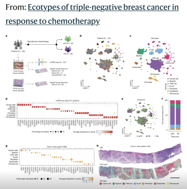 George Kumar: Mapping TNBC at Single Cell Resolution 2 George Kumar: Mapping TNBC at Single Cell Resolution