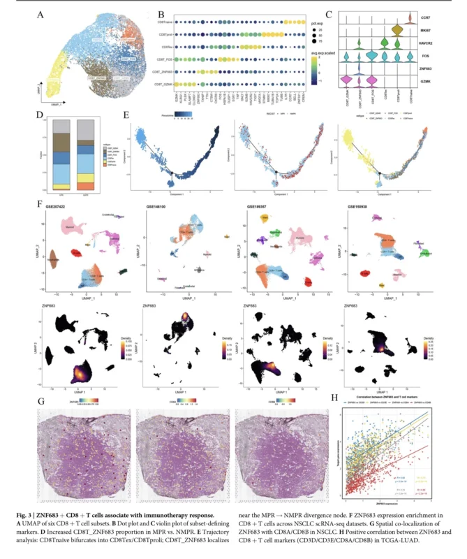 NSCLC immunotherapy response biomarker study links ZNF683+ CD8+ T cells to response and SPP1 signaling to resistance.