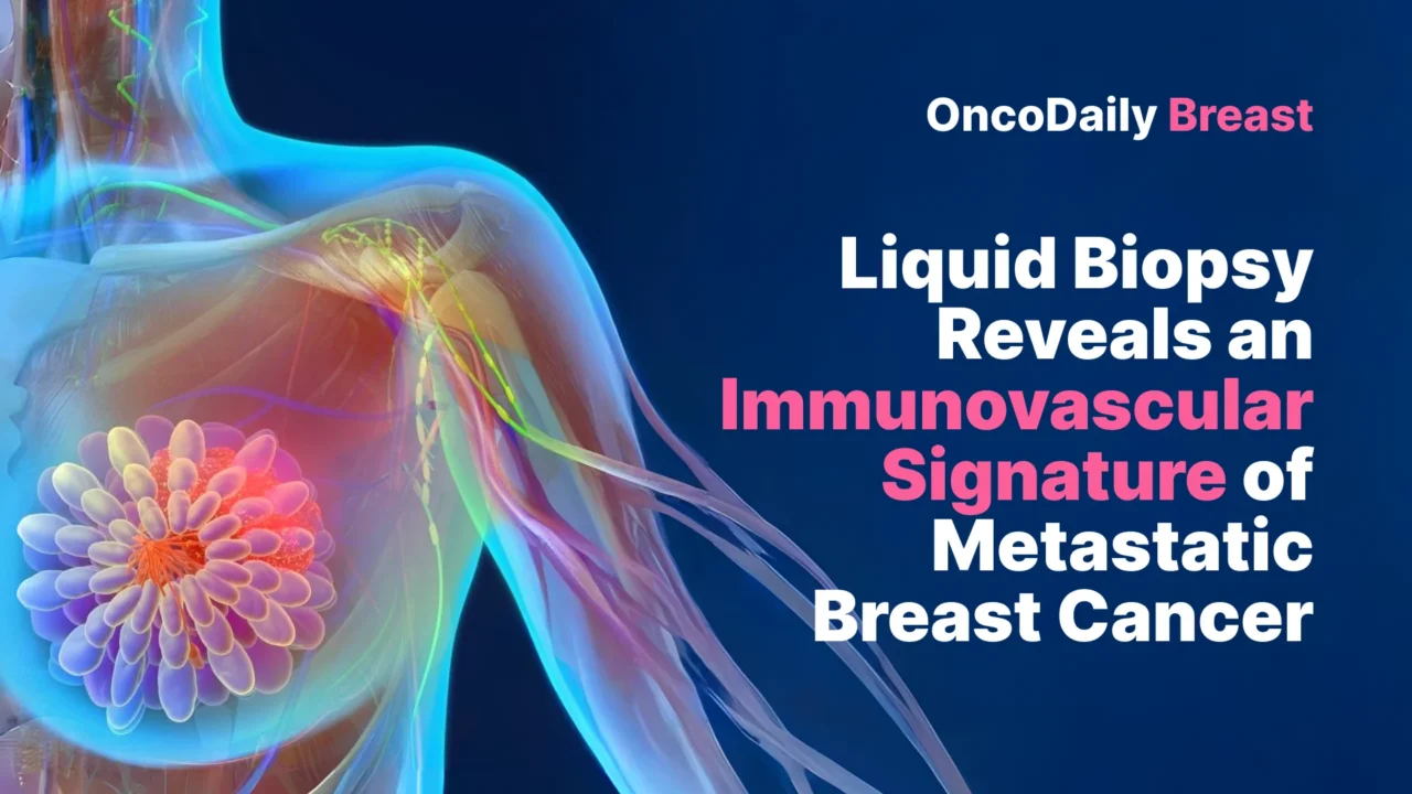 Metastatic Breast Cancer: Liquid Biopsy Reveals an Immunovascular Signature