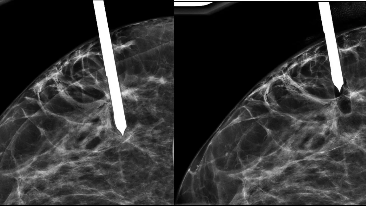 Sahar Mansour: Early Detection Isn’t Just About Finding Abnormalities – It’s About Understanding Them Correctly