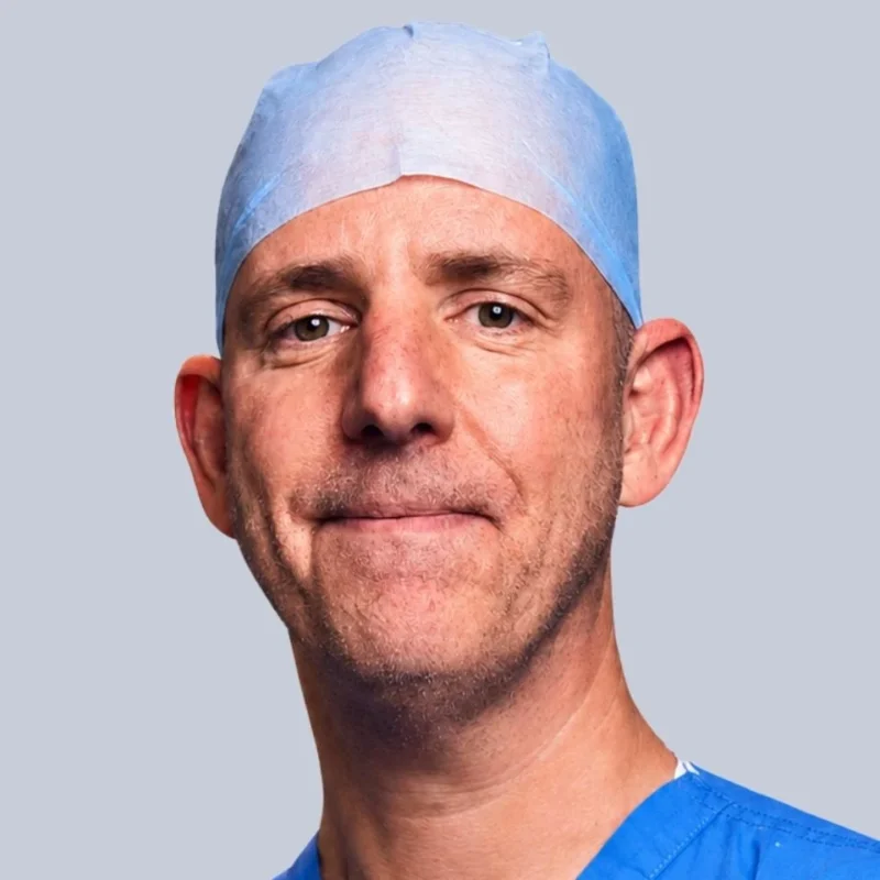 James W. Catto