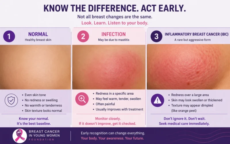 Breast Cancer in Young Women Foundation