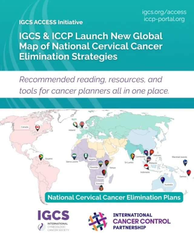 IGCS