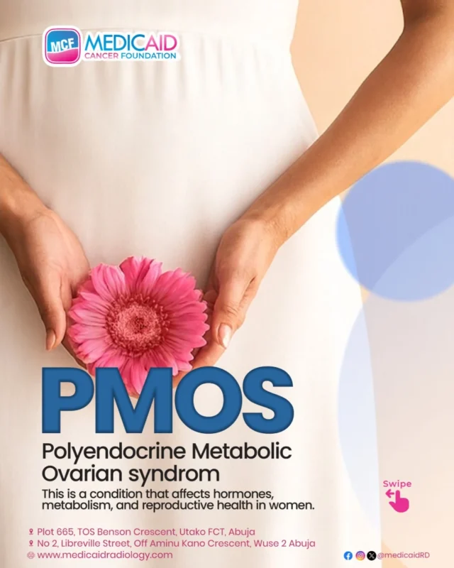 Early Awareness and Medical Guidance to Prevent PMOS - Medicaid Cancer Foundation 2 Medicaid Cancer Foundation