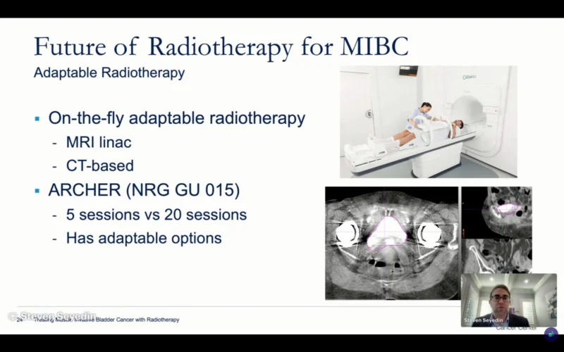 Highlights From How I Treat Bladder Cancer in 2026 Global Virtual Summit 8 bladder cancer - OncoDaily