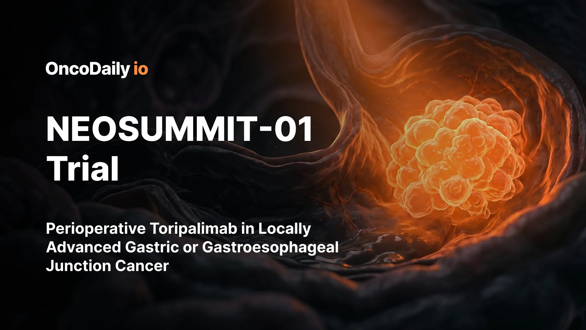NEOSUMMIT-01 Trial: Perioperative Toripalimab in Locally Advanced Gastric or Gastroesophageal Junction Cancer