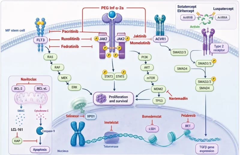 Myelofibrosis (MF) in 2026: Matching Therapy to the Dominant Clinical Problem