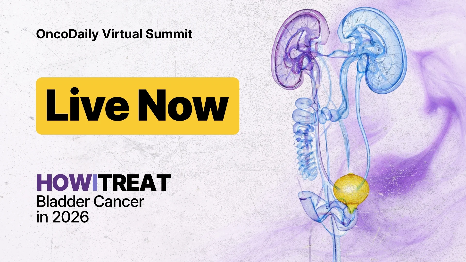 How I Treat Bladder Cancer in 2026