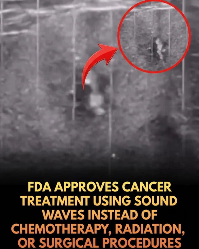 Renjith Vijayakumar Selvarani: FDA Approves Sound Wave Technology to Treat Inoperable Tumors 2 Renjith Vijayakumar Selvarani: FDA Approves Sound Wave Technology to Treat Inoperable Tumors