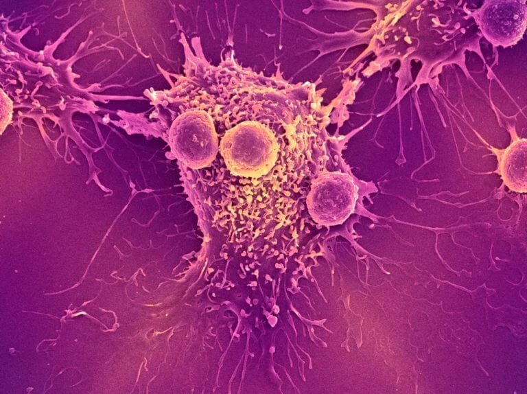 Joshua Brody Features Expert Discussion on CAR T and Bispecifics in Lymphoma 2 Joshua Brody