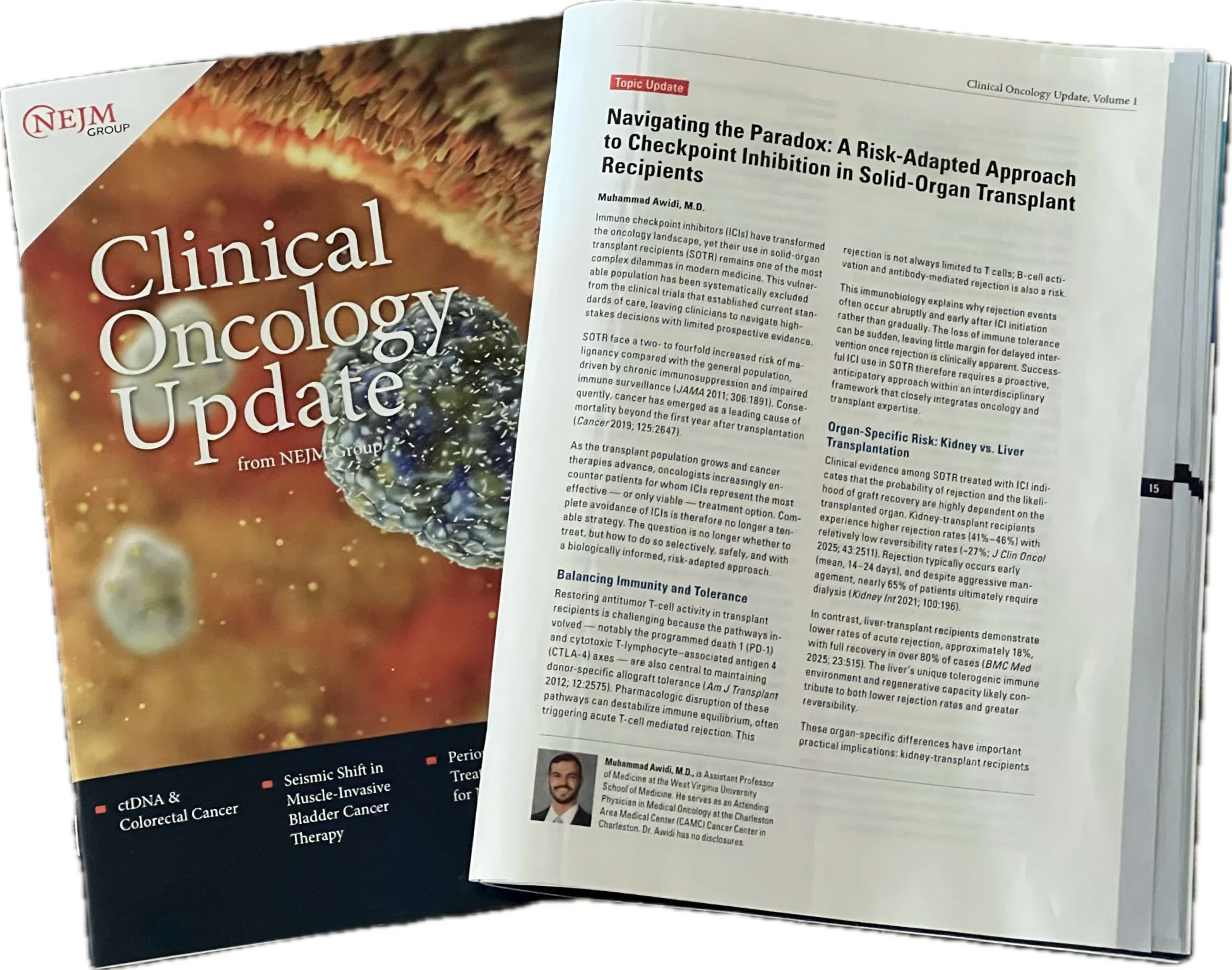 Muhammad Awidi: Honored to Write an NEJM Clinical Oncology Topic Update on ICI After Solid-Organ Transplantation