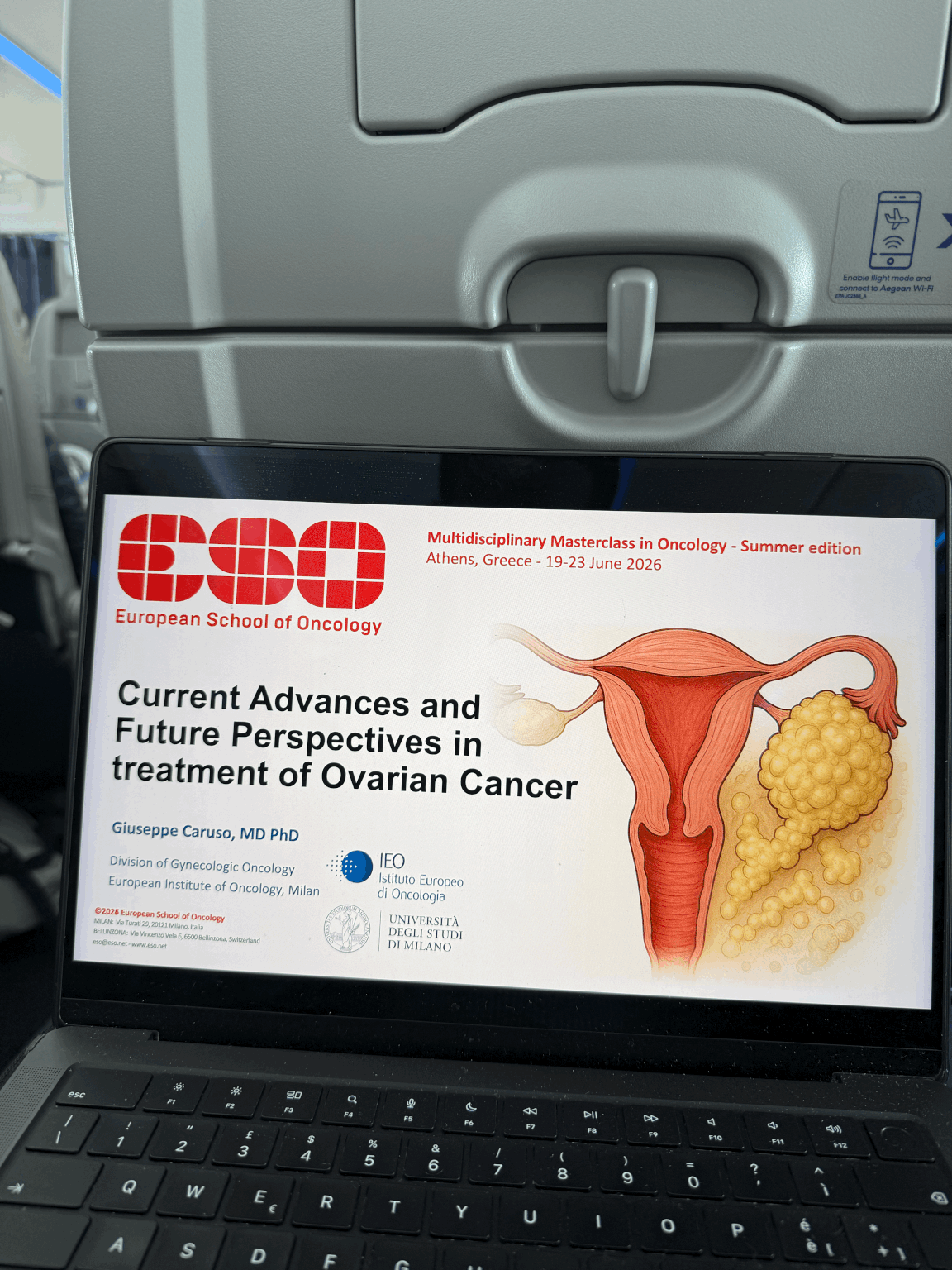 Giuseppe Caruso: Joining the ESO Multidisciplinary Masterclass to Speak on the Treatment of Ovarian Cancer 2 Giuseppe Caruso: Joining the ESO Multidisciplinary Masterclass to Speak on the Treatment of Ovarian Cancer