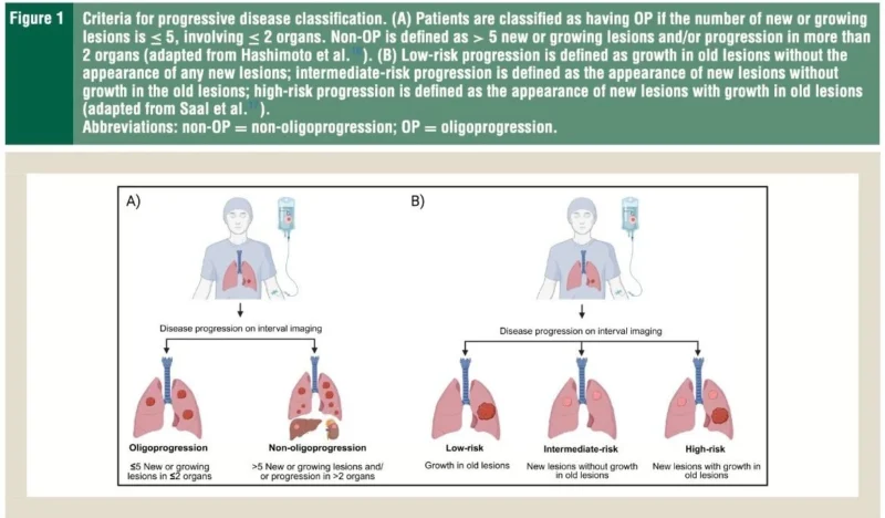 Misty Shields: How Radiographic Patterns of Progression Impact Outcomes for Patients with ES-SCLC Receiving ChemoIO 2 Misty Shields: How Radiographic Patterns of Progression Impact Outcomes for Patients with ES-SCLC Receiving ChemoIO