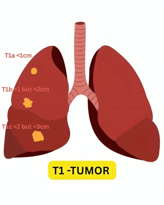 Himanshu Batra: Every Cancer Tells a Story, A Simple Framework to Read It 2 Himanshu Batra