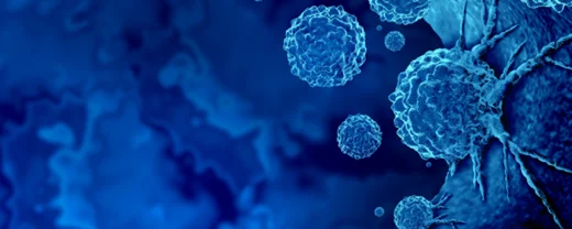 The Evolutionary Path of Metastatic Lung Cancer - Cancer Discovery 2 The Evolutionary Path of Metastatic Lung Cancer - Cancer Discovery