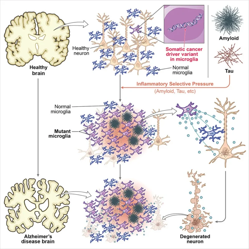 Potential New Biological Mechanism Linking Aging, Immune Dysfunction, and Alzheimer's Disease - TCC 2 Mount Sinai Tisch Cancer Center (TCC)