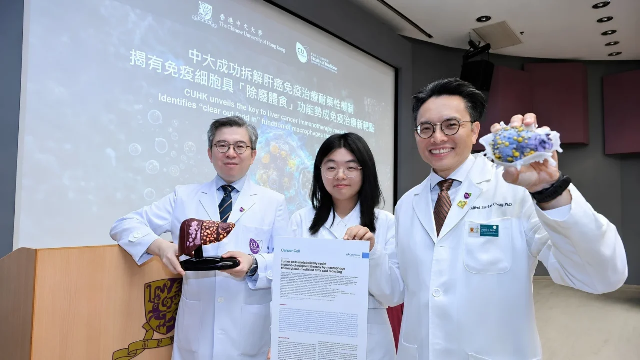 A New Article on Immunotherapy Resistance in Liver Cancer – CUHK Medicine