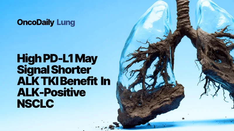 High PD-L1 Expression Linked To Shorter PFS With First-Line ALK TKIs In ALK-Rearranged NSCLC