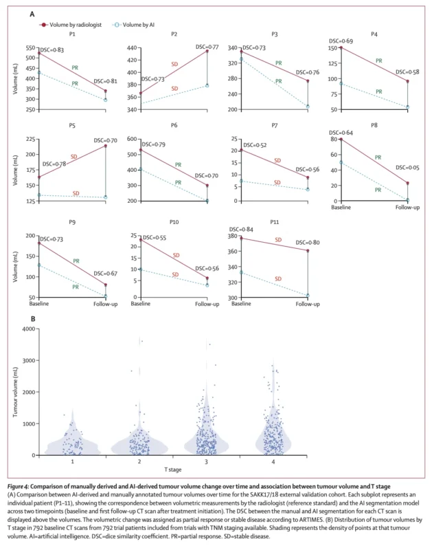 ARTIMES AI Volumetry May Improve Response Assessment in Pleural Mesothelioma 5 ARTIMES AI Volumetry May Improve Response Assessment in Pleural Mesothelioma