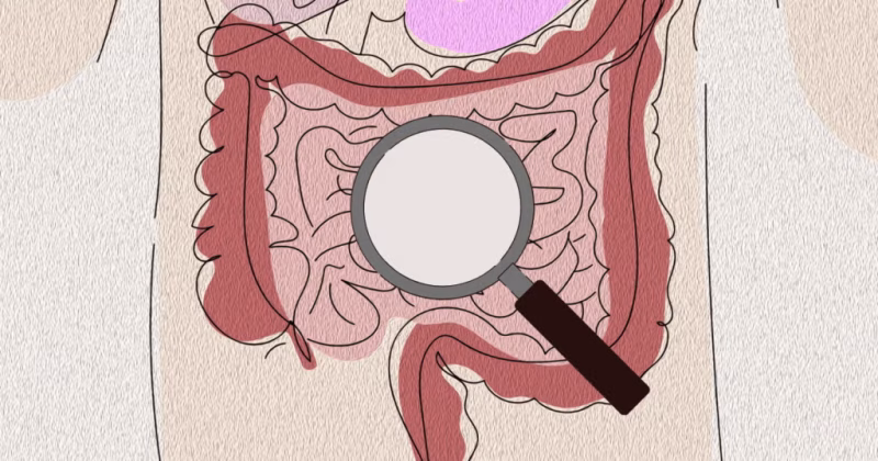 Mailed Fecal Immunochemical Tests Can Drastically Increase Colorectal Cancer Screening - UNC Lineberger 2 UNC Lineberger