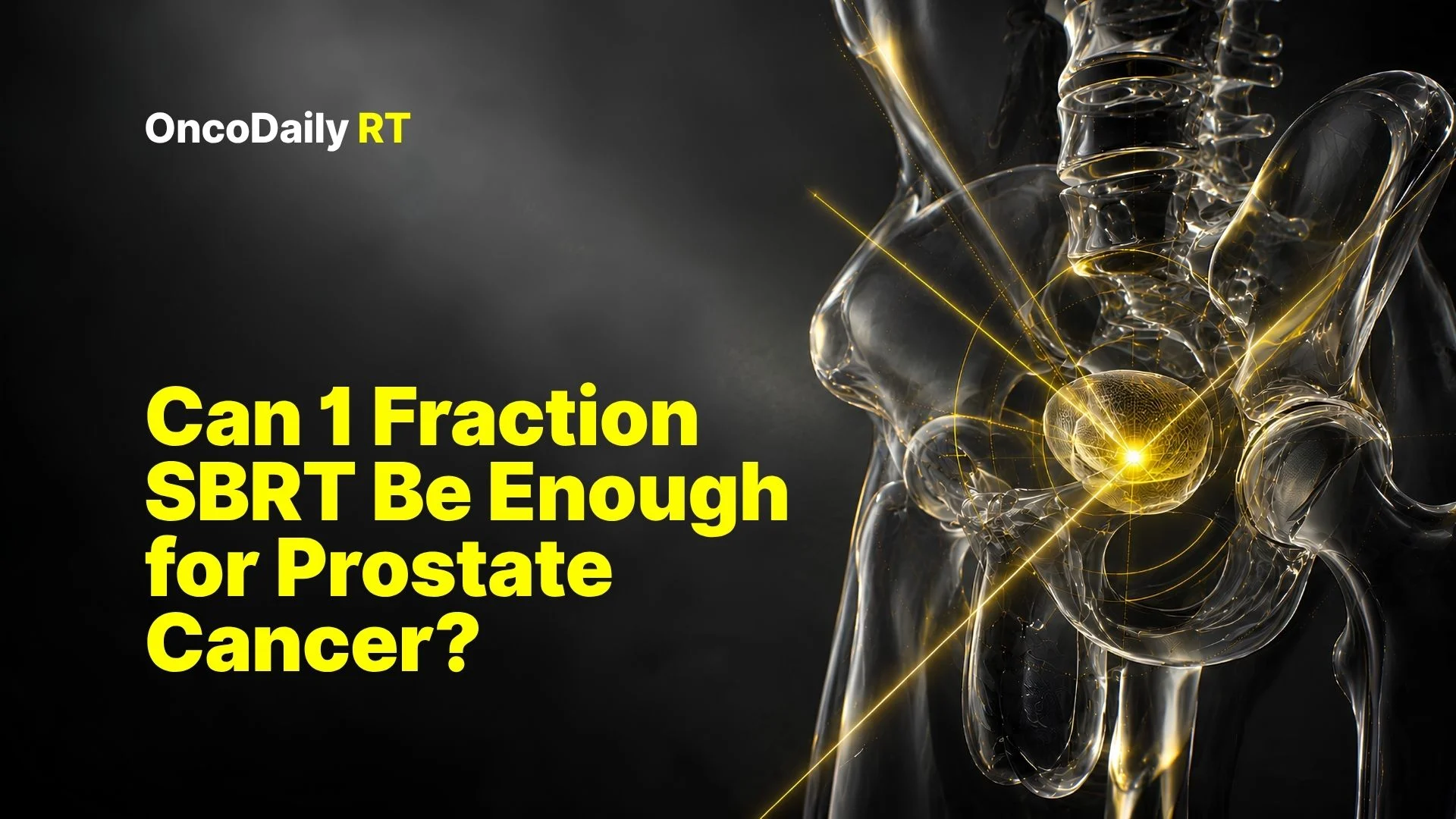 Prostate cancer