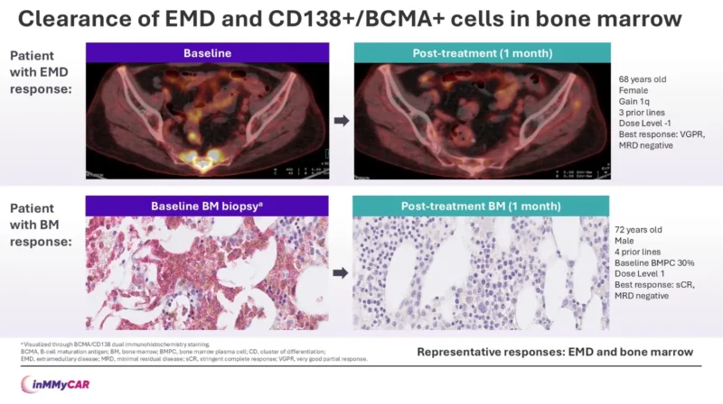 Updated inMMyCAR Results: The First Sponsored Multicenter Study of In Vivo CAR-T Therapy in RRMM 4 Updated inMMyCAR Results: The First Sponsored Multicenter Study of In Vivo CAR-T Therapy in RRMM
