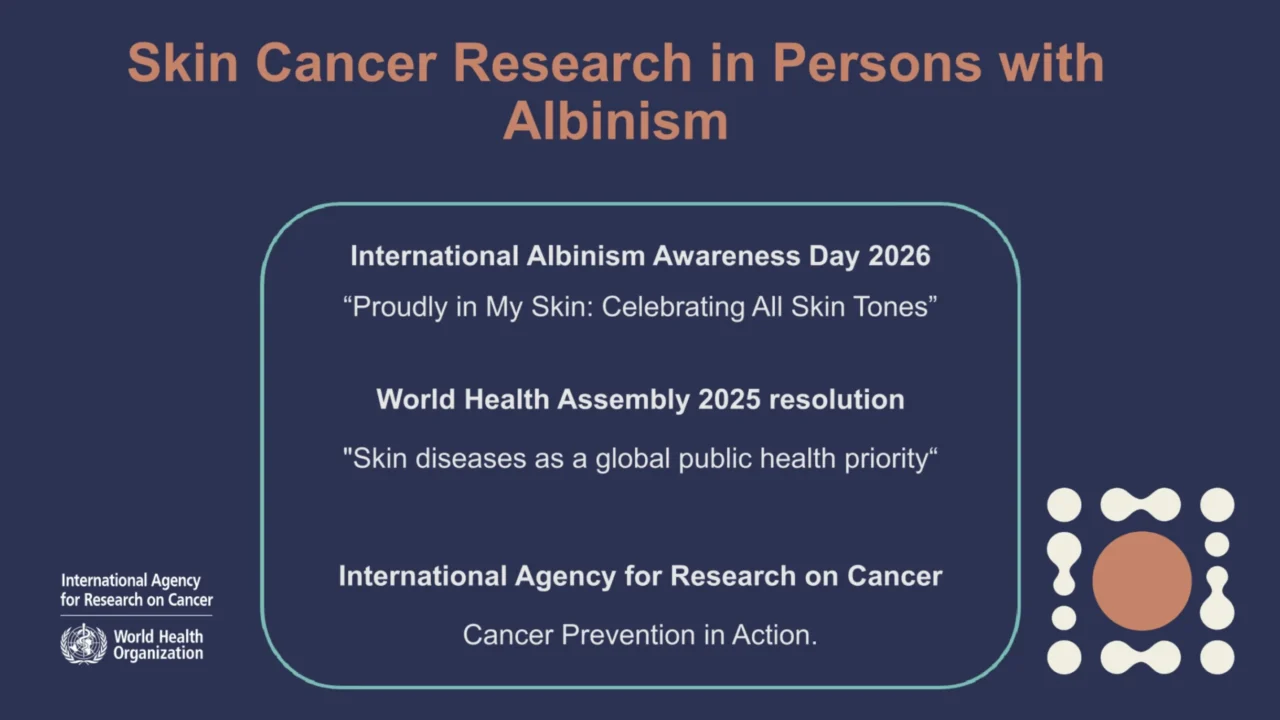 Reducing Cancer Risk for People With Albinism Through Research and Collaboration – IARC