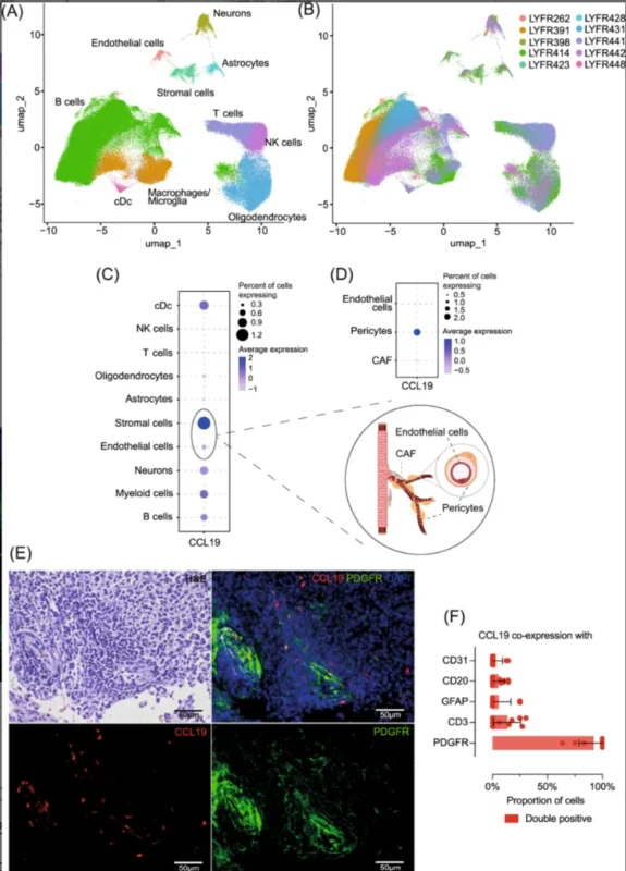 Spatial and Multi-Omics Reveal Pericyte-Derived CCL19 as an Adverse Prognostic Factor in CNS Lymphoma