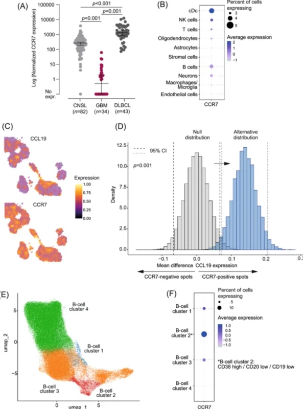 Spatial and Multi-Omics Reveal Pericyte-Derived CCL19 as an Adverse Prognostic Factor in CNS Lymphoma