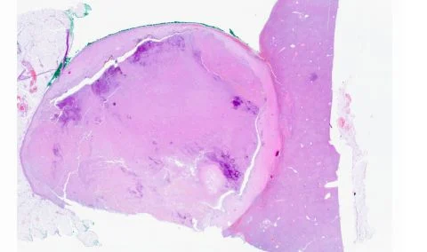 Chris Poulios: Highlighting the Role of Pathology in Modern Healthcare