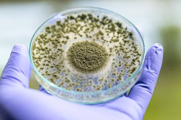 Aflatoxin in Food: The Cancer-Causing Toxin Linked to Liver Cancer 3 Aflatoxin in food