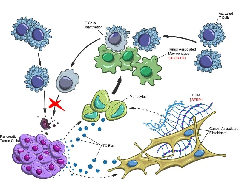Zainab Hussain: Proud to Share Our Latest JCI Study on Pancreatic Cancer