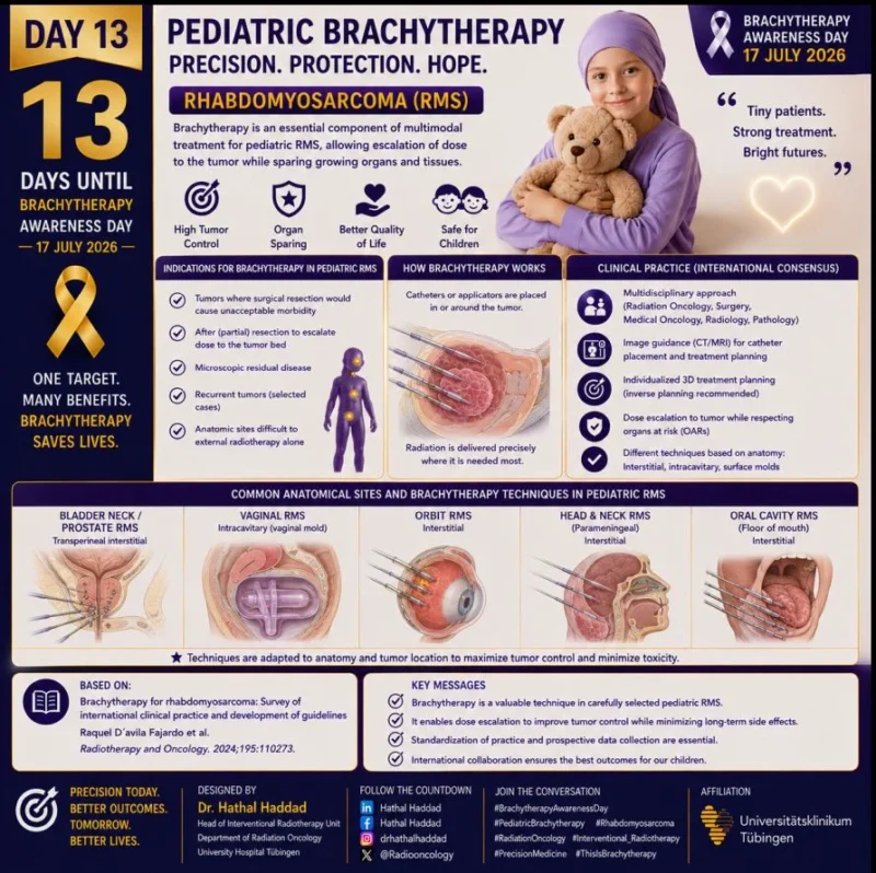 Hathal Haddad: Brachytherapy in the Multidisciplinary Management of Pediatric Rhabdomyosarcoma 2 Hathal Haddad