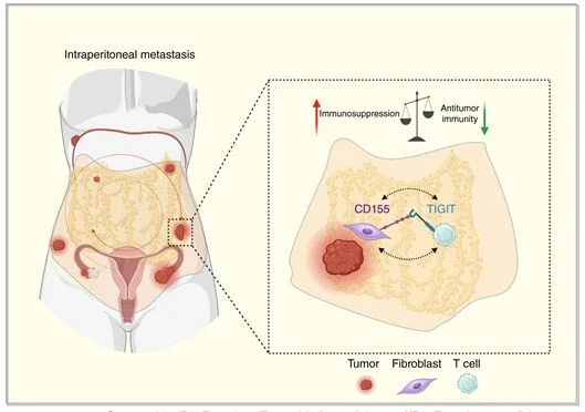 Neta Erez: Excited to Share Our Latest Work in Cancer Research on Ovarian Cancer Metastasis 2 Neta Erez