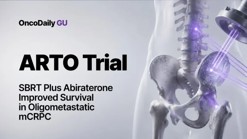 ARTO Trial: SBRT Plus Abiraterone Improved Survival in Oligometastatic mCRPC