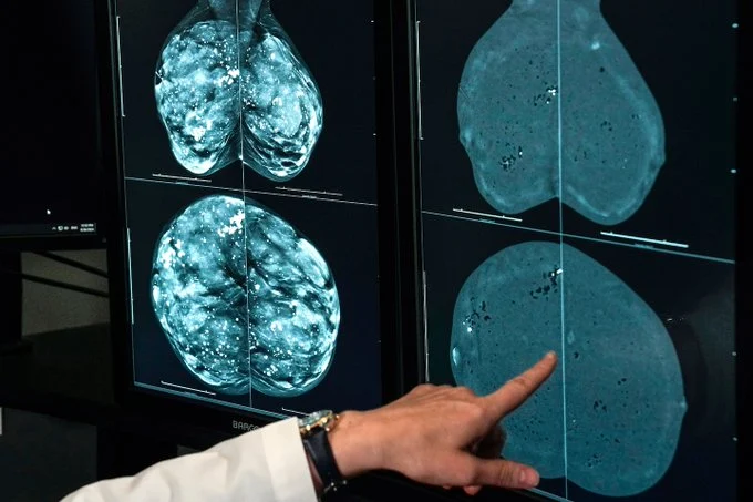 Pat Soon-Shiong: Addressing the Global Cancer Pandemic with Immunotherapy and Cell Therapy