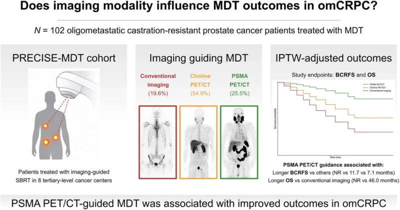 PSMA PET/CT Guidance Linked to Longer Biochemical Control in Oligometastatic Castration-Resistant Prostate Cancer 2 PSMA