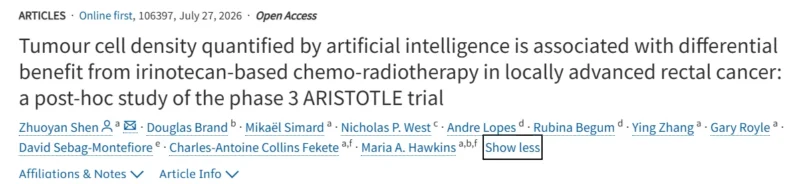 George L. Kumar: Can AI Predict Benefit From Intensified Chemoradiotherapy?