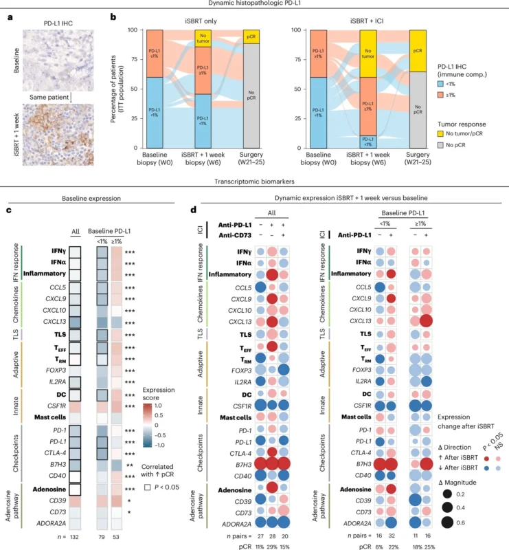 Luca Arecco: Can Radiotherapy Make "Cold" Breast Cancers Sensitive to Immunotherapy? 5 Luca Arecco: Can Radiotherapy Make "Cold" Breast Cancers Sensitive to Immunotherapy?