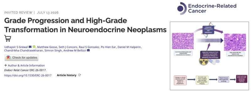 Udhayvir Grewal։ Exploring High - Grade Progression and Transformation in Neuroendocrine Neoplasms 2 Udhayvir Grewal