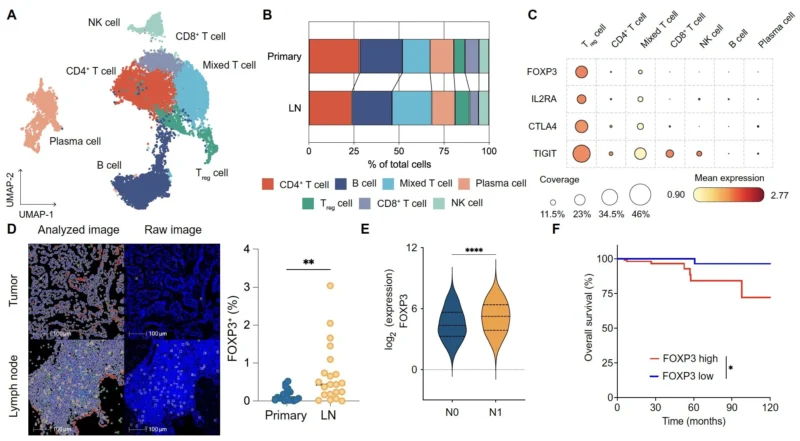 Anthony T. Nguyen: Study Reveals How Thyroid Cancer Migrates to Lymph Nodes and Its Impact on Prognosis 3 Anthony T. Nguyen