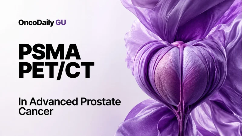 PSMA PET/CT Guidance Linked to Longer Biochemical Control in Oligometastatic Castration-Resistant Prostate Cancer