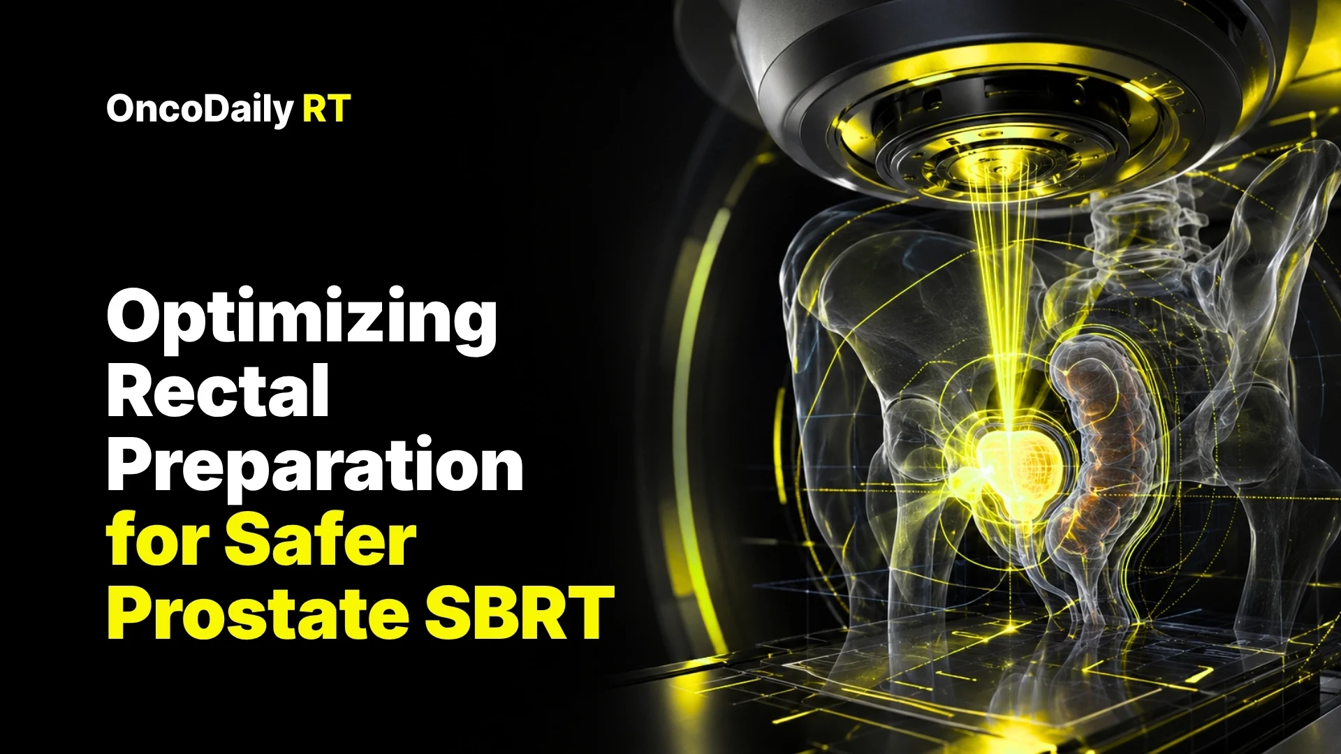 Prostate SBRT
