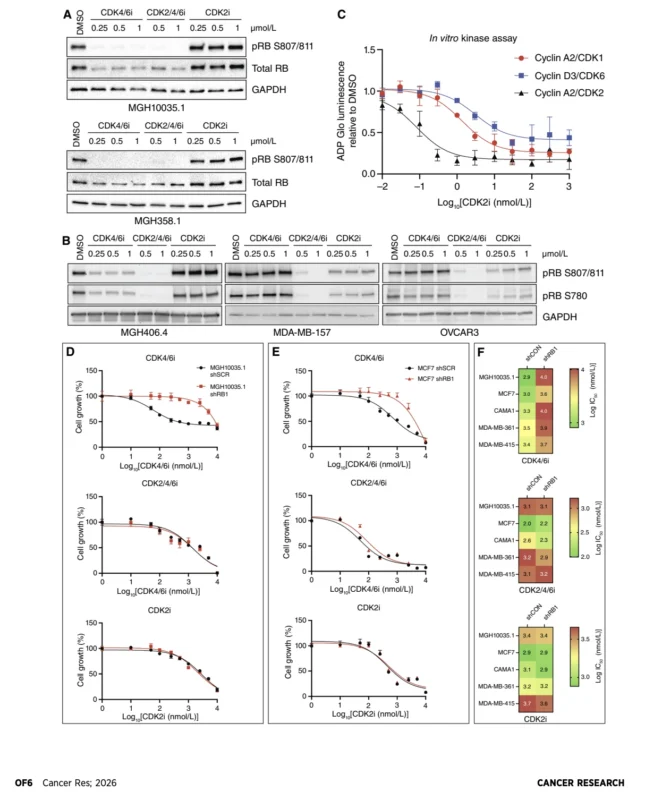 CDK2 Inhibition in CDK4/6 - Resistant Breast Cancer: A New Escape Route Under Study 3 CDK4/6