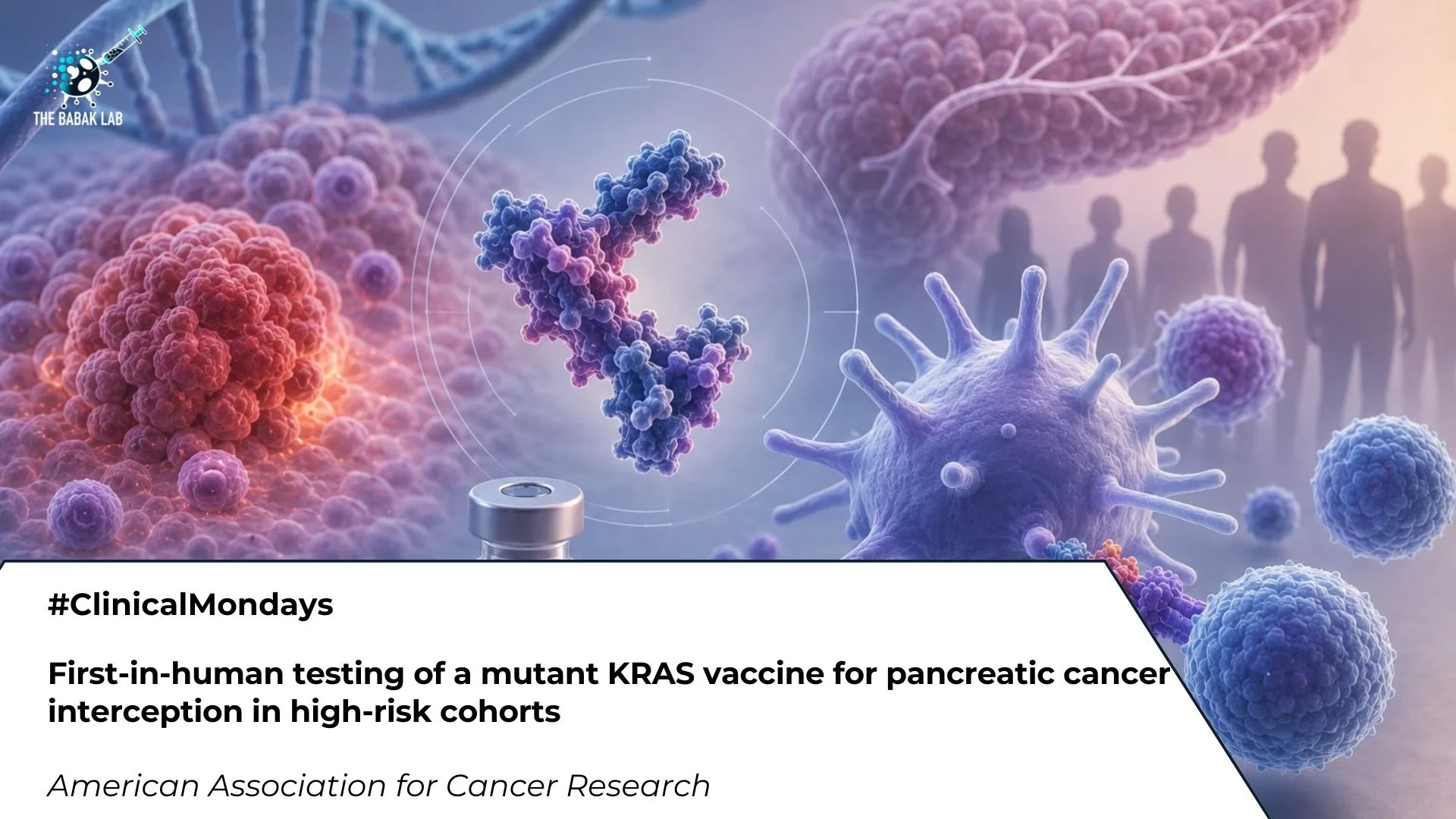 Maria Babak: A Promising Step Forward for Pancreatic Cancer Interception 2 Maria Babak: A Promising Step Forward for Pancreatic Cancer Interception