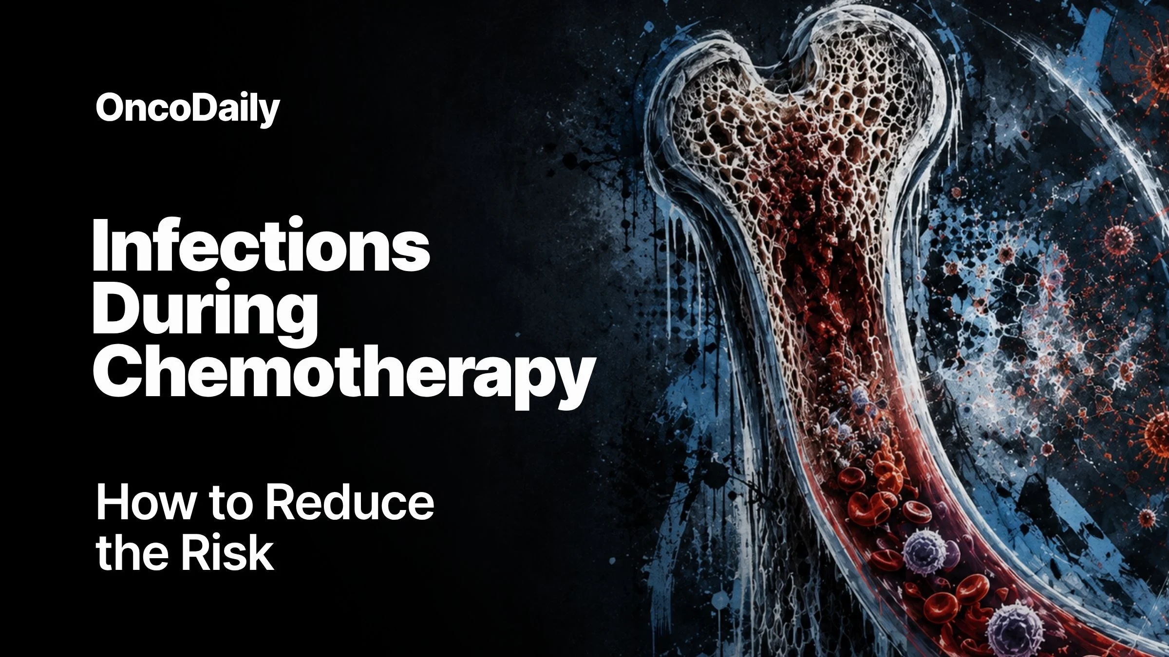 Infections During Chemotherapy and How to Reduce the Risk