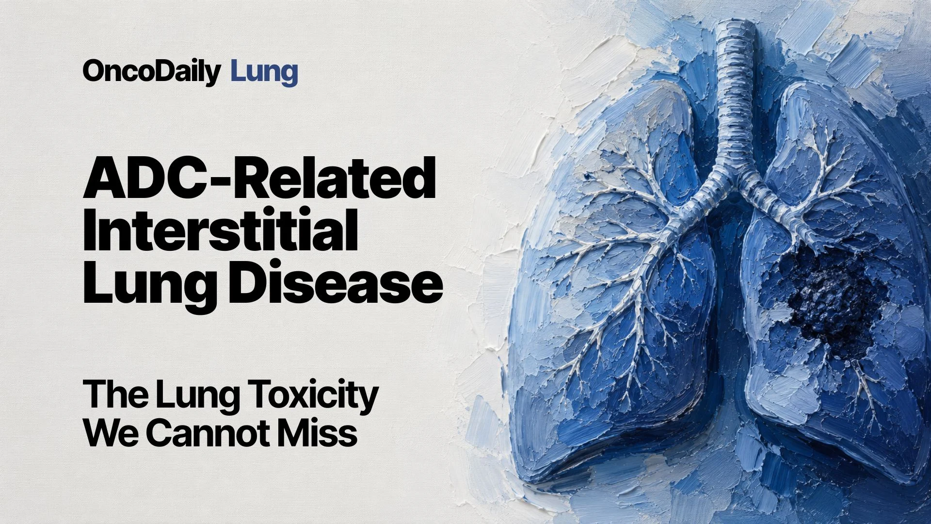 Interstitial Lung Disease