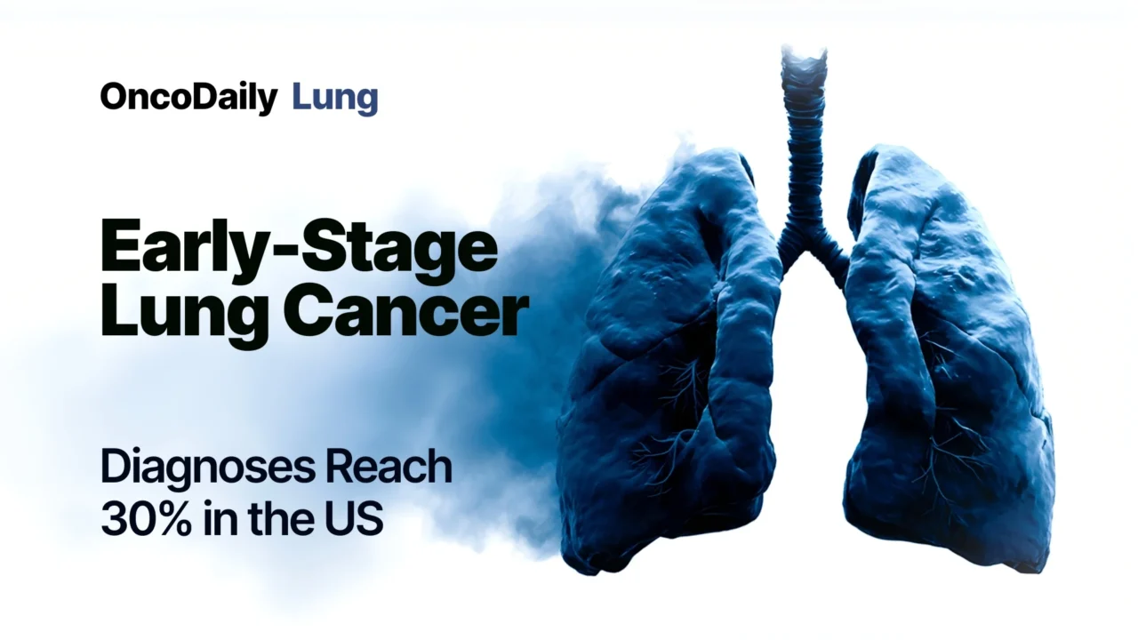 Early-Stage Lung Cancer Diagnoses Rise Across the United States