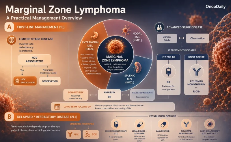 Marginal Zone Lymphoma (MZL): Chronic Immune Stimulation, Heterogeneity and Beyond